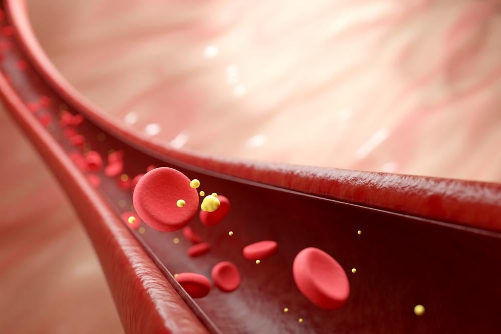 Cholesterol thấp là như thế nào? Có nguy hiểm không?