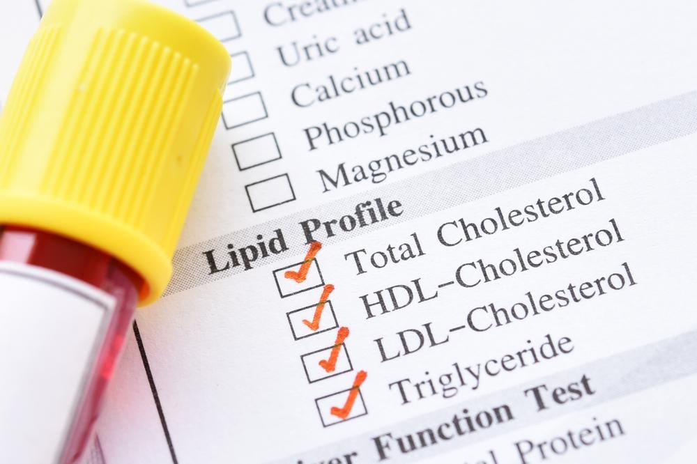 Công thức tính cholesterol toàn phần