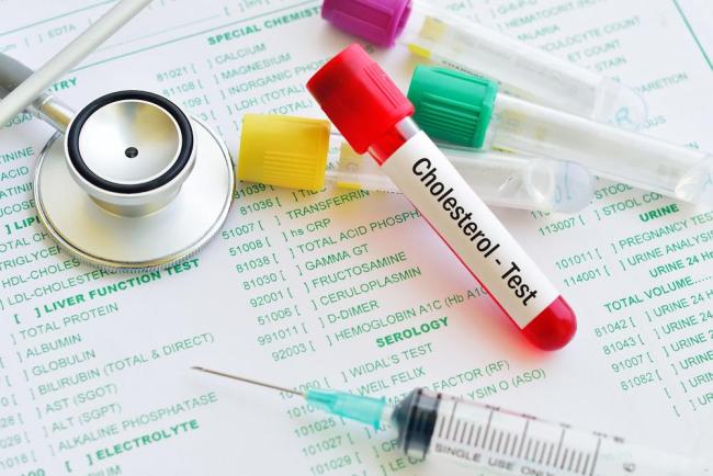 Định lượng cholesterol toàn phần là gì? Đọc để hiểu rõ!