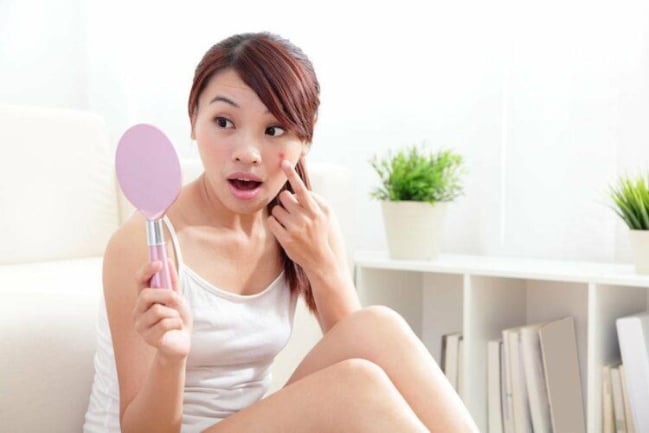 Mụn trứng cá