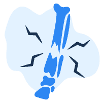 Rạn xương, gãy xương