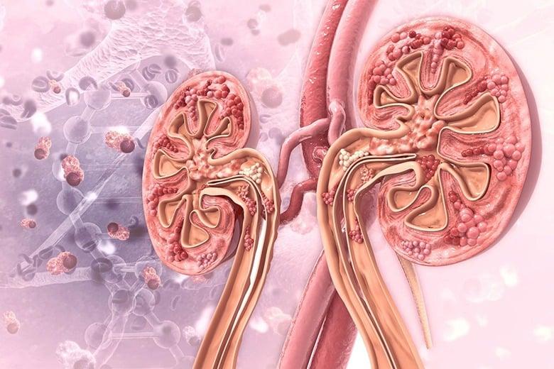 nguyên nhân hình thành sỏi tiết niệu