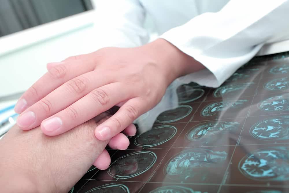 Bệnh u não sống được bao lâu?