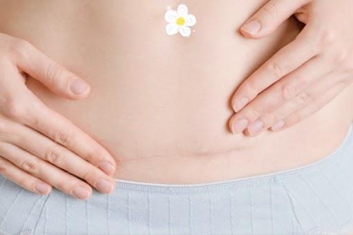 Mách mẹ cách xây dựng miễn dịch  vững vàng cho bé sinh mổ