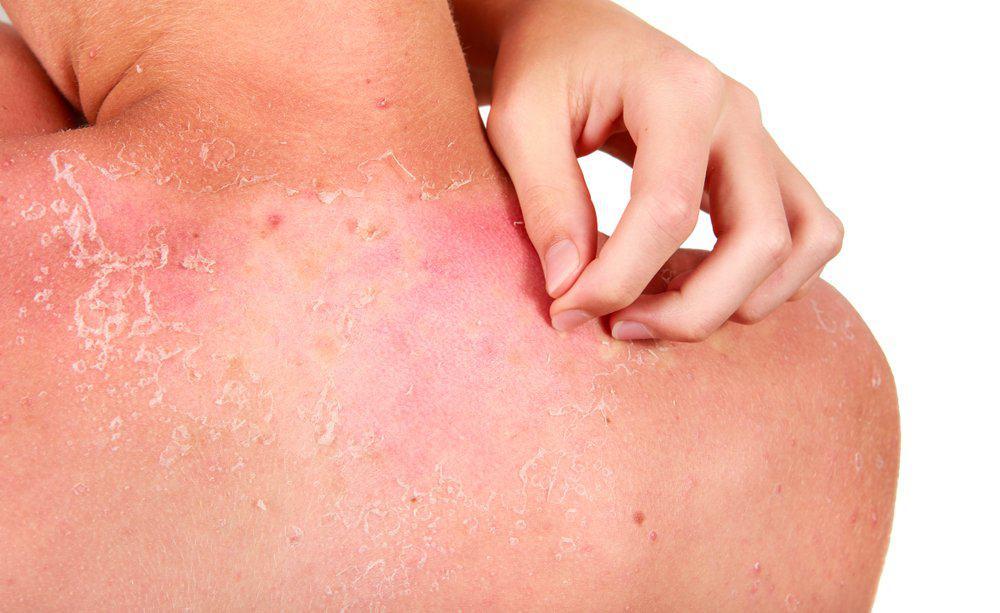 9 sai lầm khi giải nhiệt cơ thể trong thời tiết nắng nóng