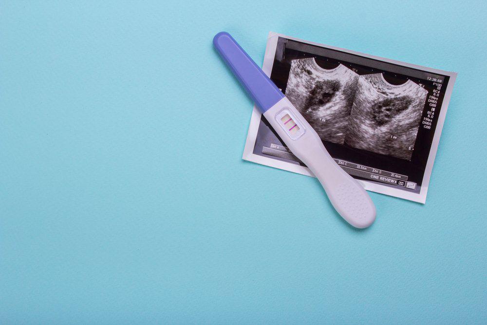 Đi tìm lời đáp về nguyên nhân siêu âm không thấy thai