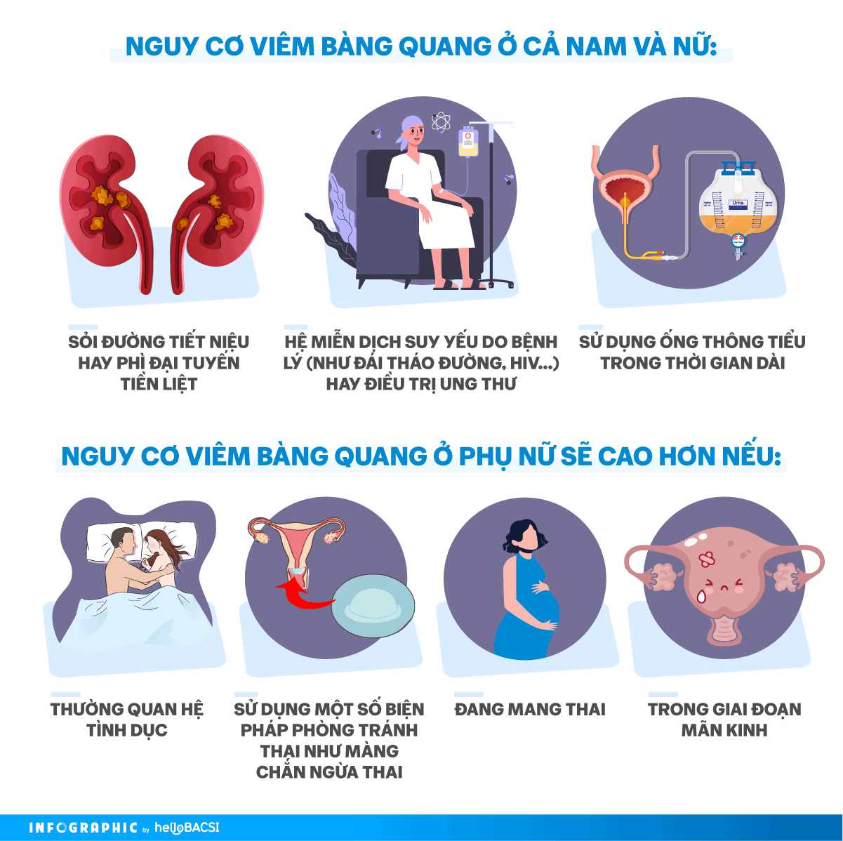 nguy cơ mắc triệu chứng viêm bàng quang