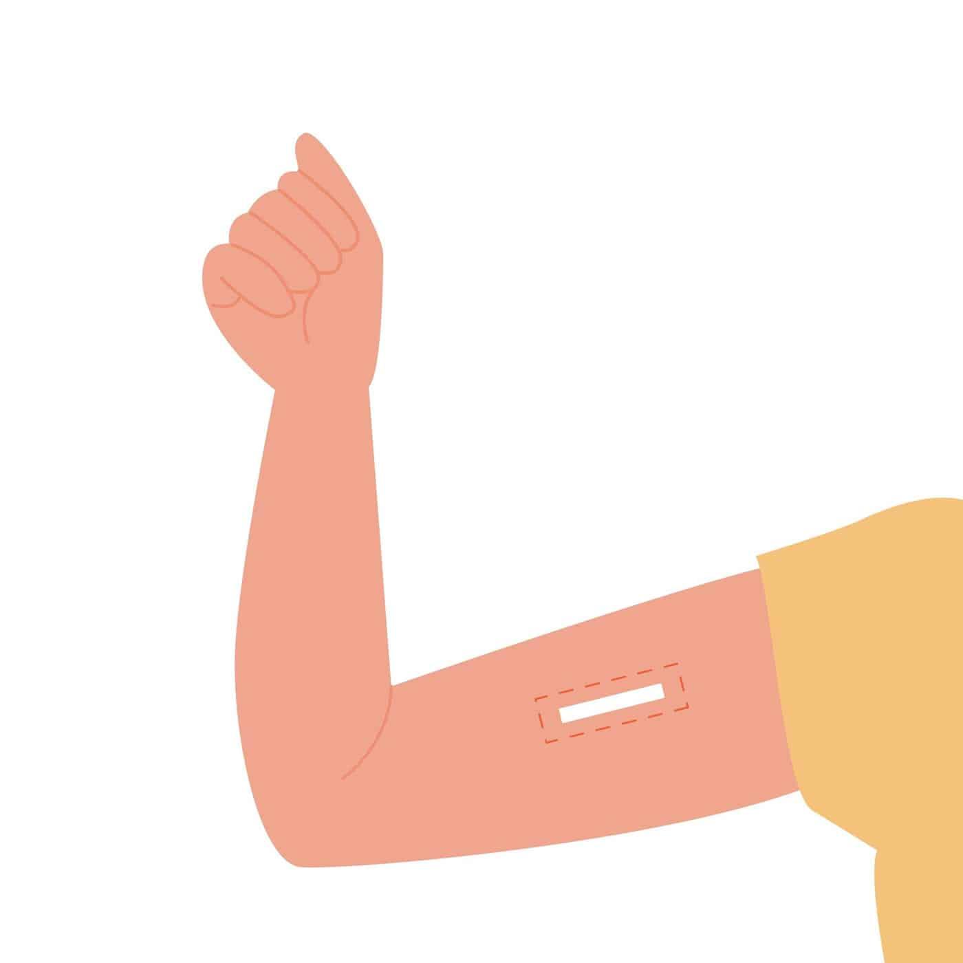 Cấy que tránh thai bao lâu thì quan hệ được?