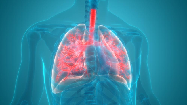Viêm phổi hít: Dấu hiệu, nguyên nhân và cách điều trị