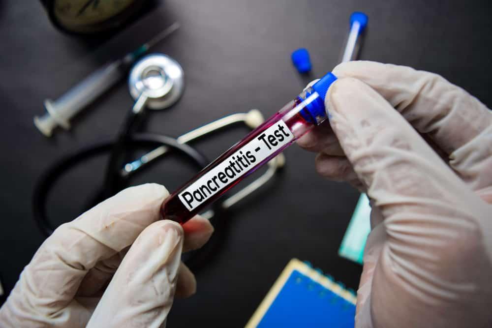Phát hiện sớm triệu chứng viêm tụy, giảm nhiều rủi ro