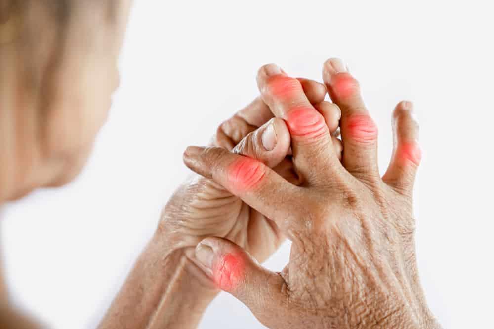Đau sưng khớp - Triệu chứng viêm khớp dạng thấp