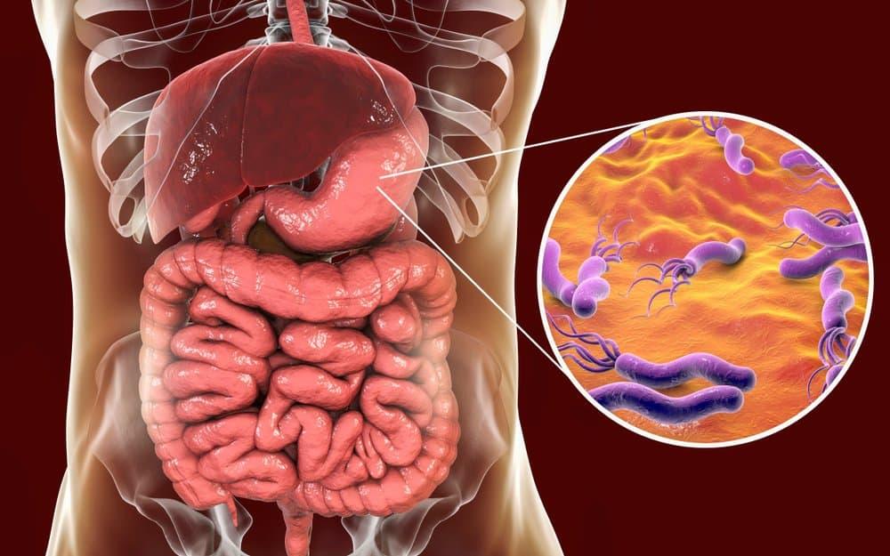 Nhiễm vi khuẩn HP là gì? Triệu chứng và các nguy cơ không thể xem nhẹ