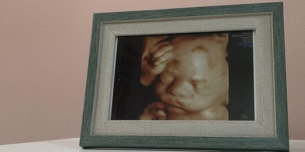 Siêu âm 5D có an toàn không? Những thông tin quan trọng cần biết