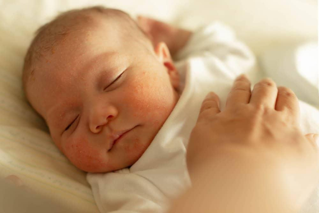 Lông mày trẻ sơ sinh có vảy do đâu? Mách mẹ cách chăm sóc tốt nhất
