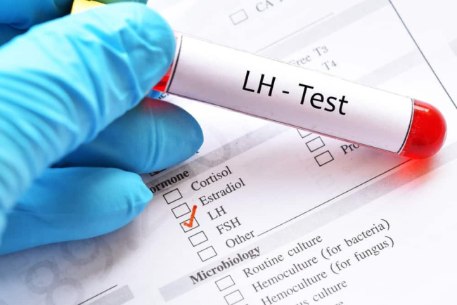 Xét nghiệm LH để làm gì? - Hướng dẫn đọc kết quả