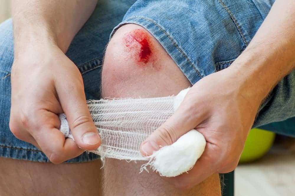 Hỏi đáp Dược sĩ: Vết thương hở nên bôi thuốc gì?