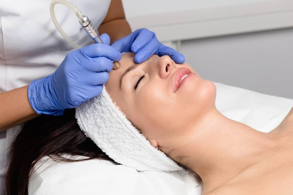 Microdermabrasion là gì? Có nên mài da vi điểm cho da?