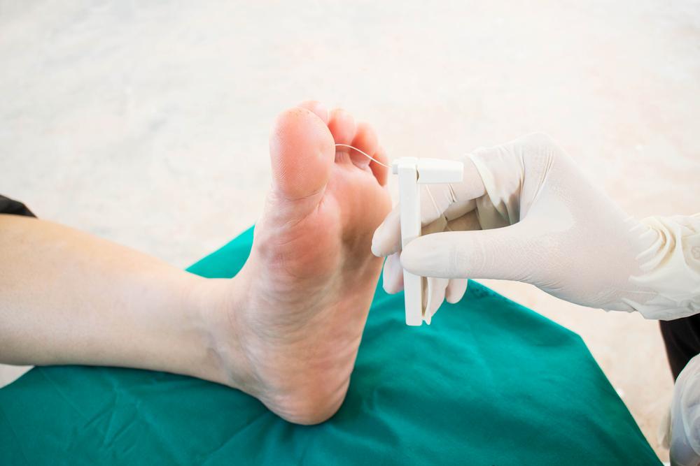 biến chứng mạch máu nhỏ của bệnh tiểu đường - bệnh thần kinh