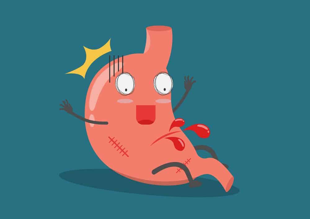 dấu hiệu chảy máu dạ dày 