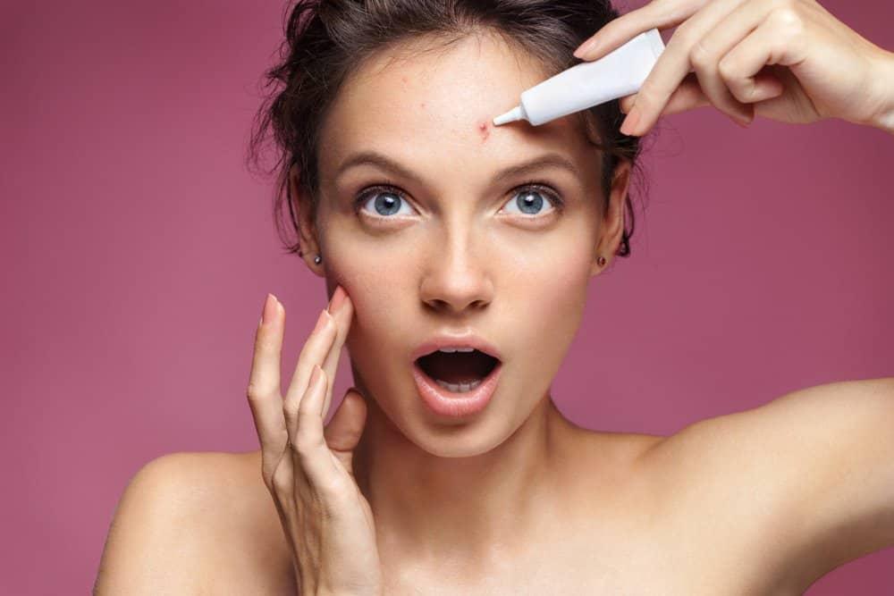 Hướng dẫn các bước skincare cho da mụn