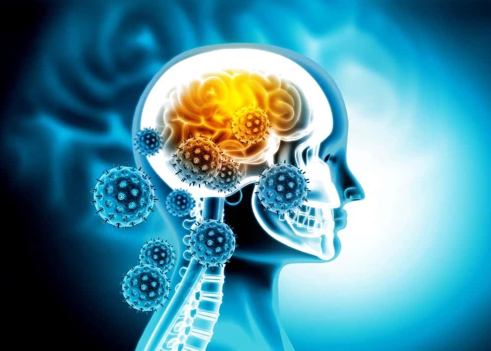 nguyên nhân rối loạn tiền đình