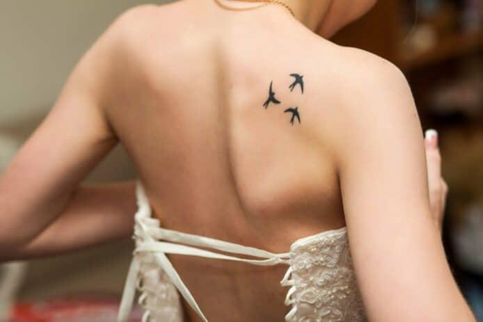 Xóa xăm laser có để lại sẹo không?