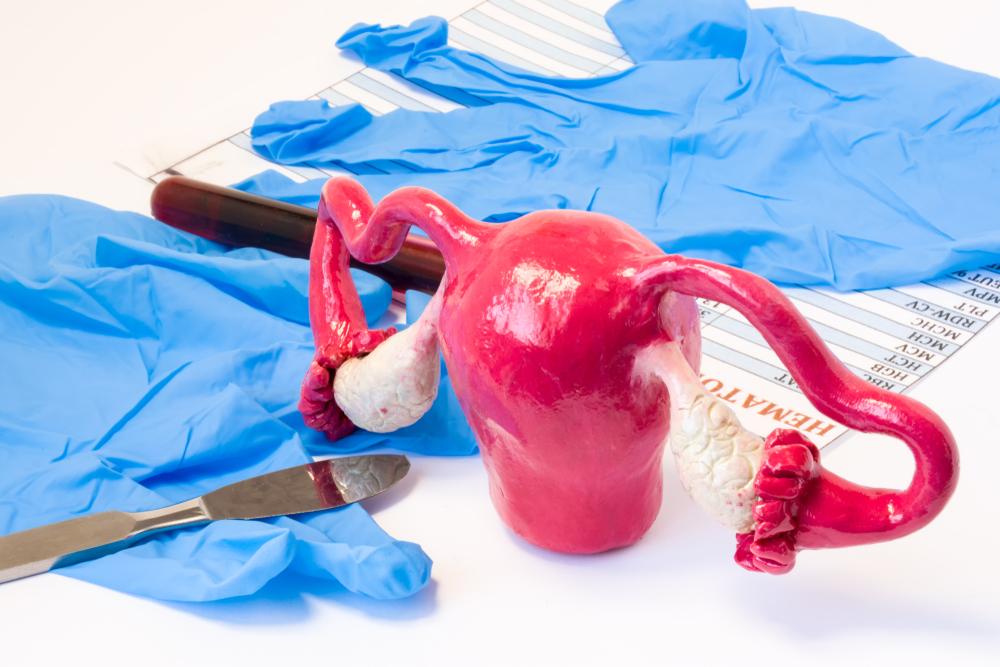 [Giải đáp] Phẫu thuật cắt 1 bên vòi trứng có ảnh hưởng gì không?