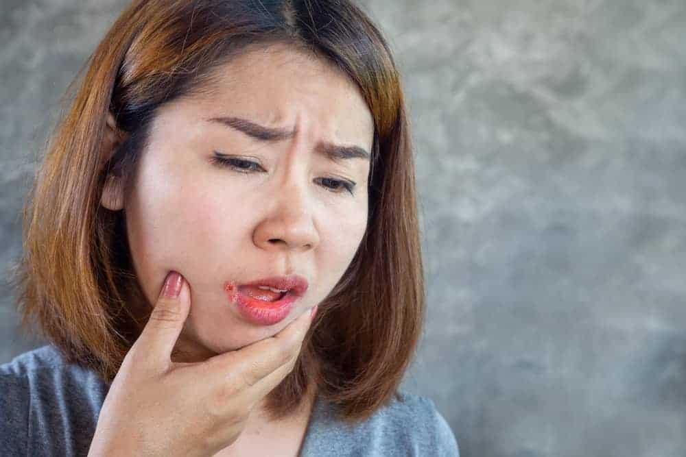 Môi bị chàm: Tình trạng phổ biến nhưng dễ nhầm lẫn!