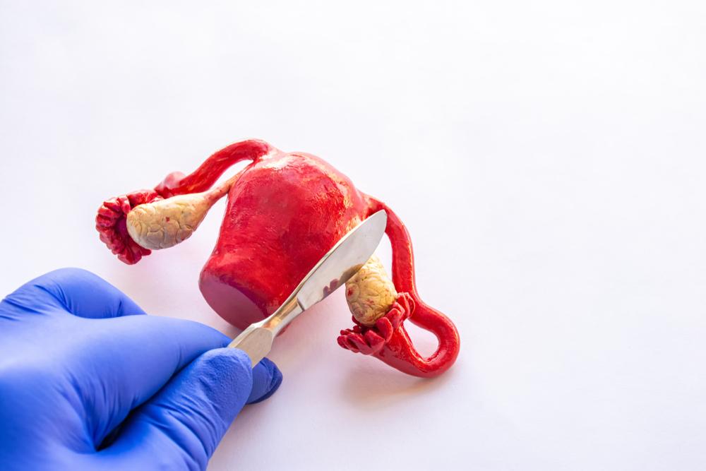 Cắt bỏ buồng trứng có ảnh hưởng gì không? 9 rủi ro sức khỏe thường gặp