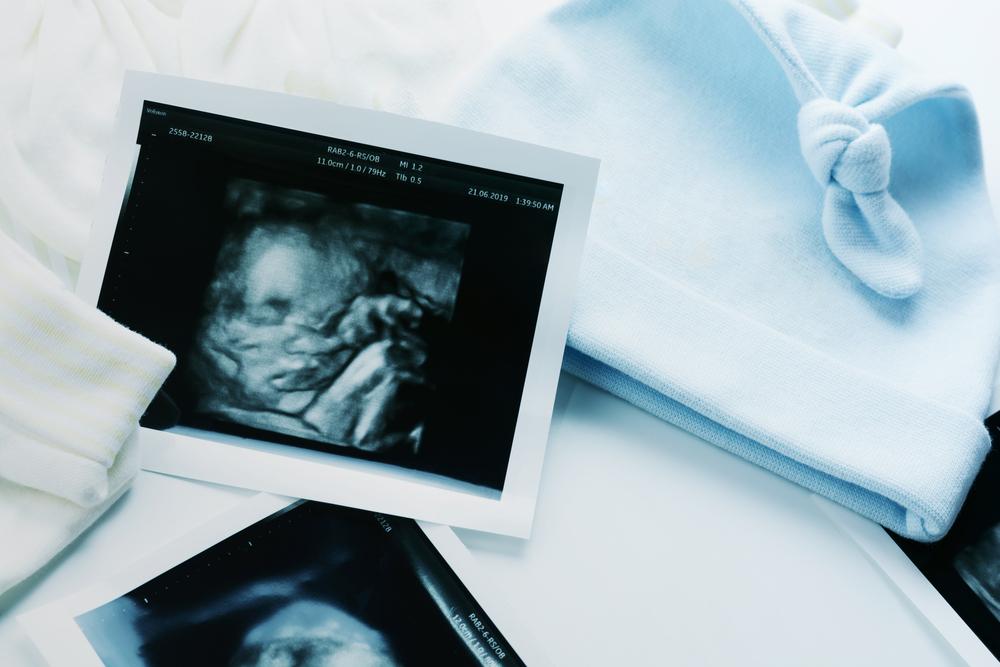 Siêu âm hình thái học: Những điều mẹ bầu cần biết!