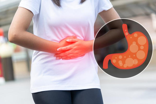 Triệu chứng đau dạ dày: Bạn đã nhận biết đúng các biểu hiện của bệnh?