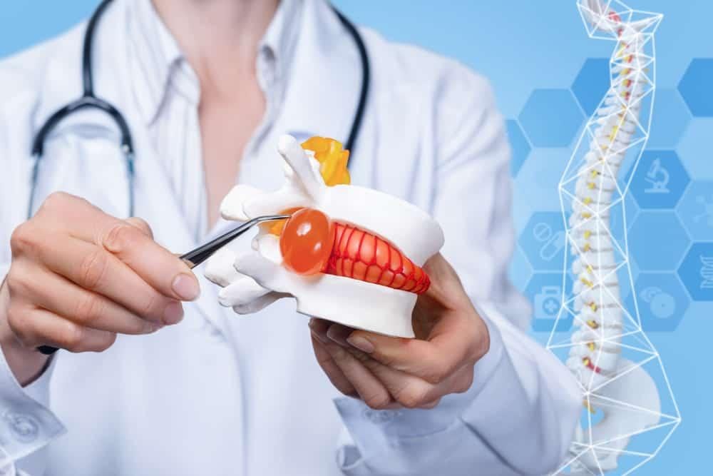 Hỏi đáp bác sĩ: Mổ thoát vị đĩa đệm bao lâu thì hồi phục?