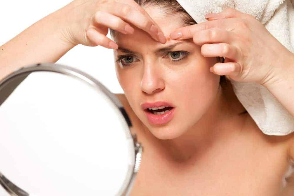 Hỏi đáp Bác sĩ: Nặn mụn xong có nên rửa mặt không?