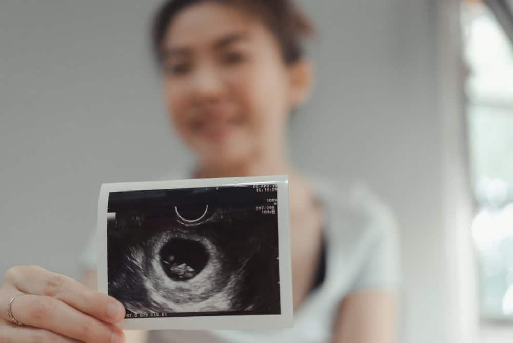 Hỏi đáp Bác sĩ: Thai 8 tuần đã bám chắc chưa, cần làm gì để có thai kỳ khỏe mạnh?