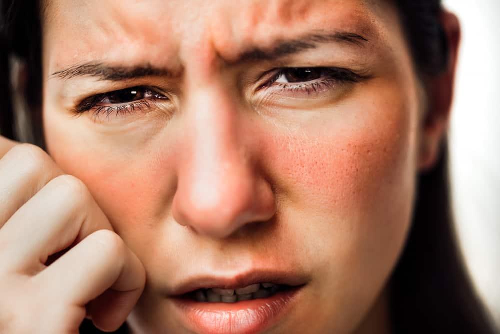 Những điều cần biết về chàm da mặt để tránh lan rộng và sẹo