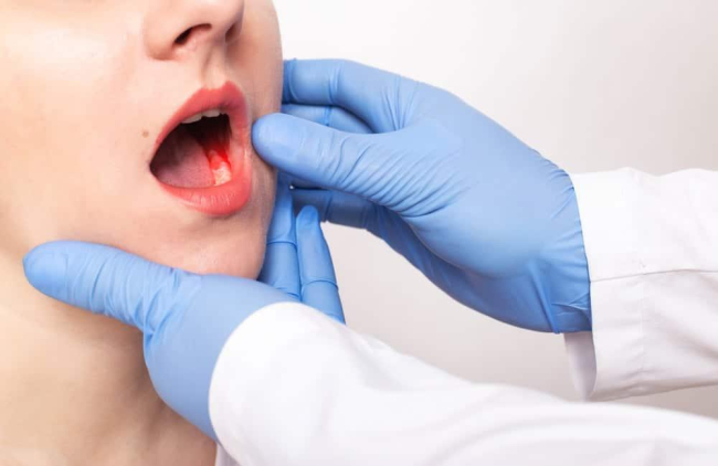 Các loại kháng sinh răng lợi: Hiểu để dùng đúng