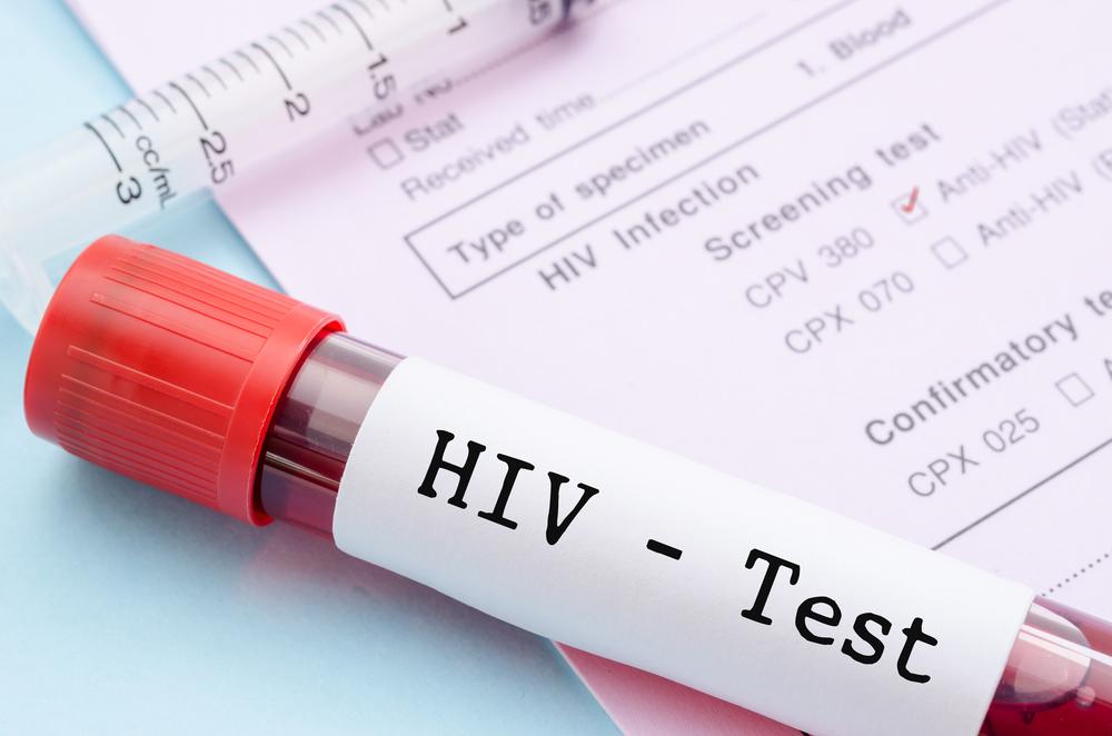 Xét nghiệm HIV AB Test nhanh có chính xác không?