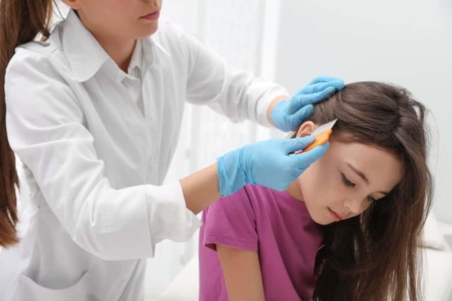 Nấm da đầu ở trẻ em - Cách nhận biết, điều trị và phòng ngừa