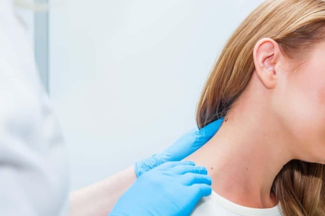 Tẩy nốt ruồi bao lâu thì bong vảy và cách chăm sóc để mau lành?
