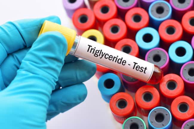 Định lượng triglycerid máu là gì? Kết quả cao hay thấp là bệnh nào?