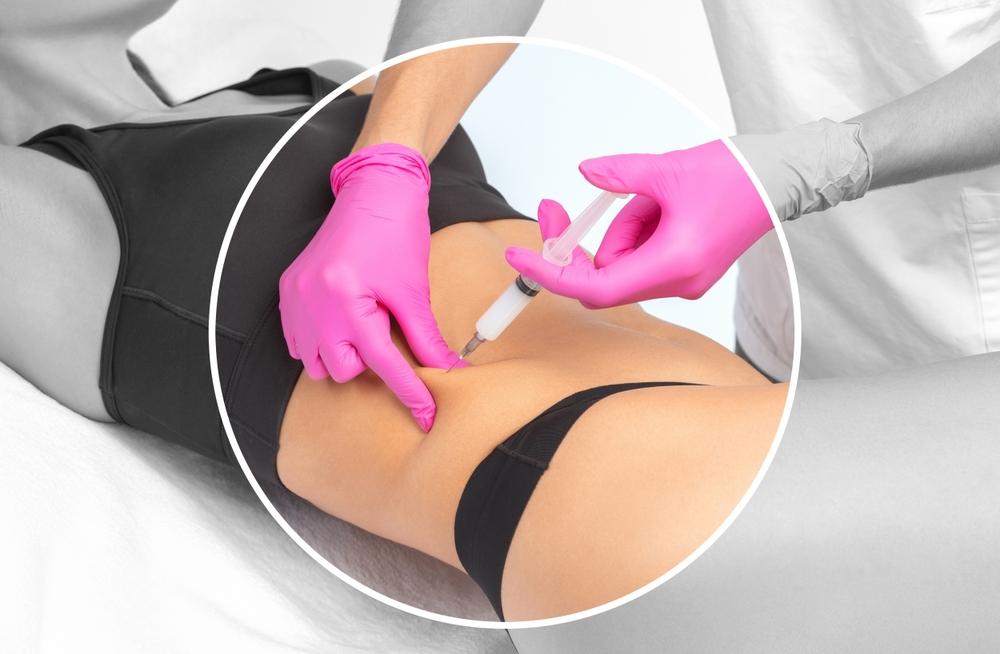 Tiêm dưới da: Vị trí, kĩ thuật, cách tiêm cho người chưa có kinh nghiệm