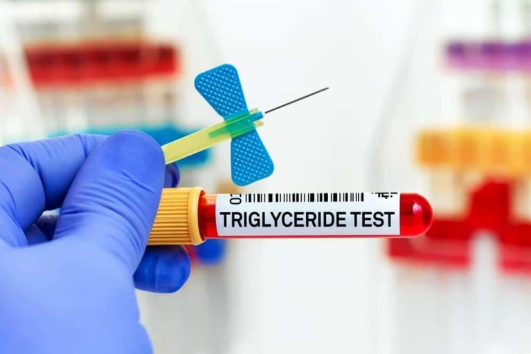  nh l ng triglycerid m u l g k t qu cao hay th p c b nh kh ng 