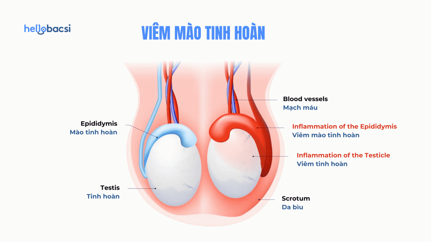 Viêm mào tinh hoàn bao lâu thì khỏi? Có điều trị được không?