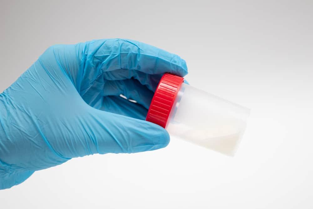 Làm sao để xuất tinh ra nhiều tinh trùng? 8 cách tăng số lượng tinh trùng