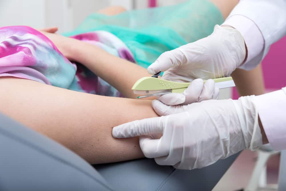 Tìm hiểu 12 tác dụng phụ của cấy que tránh thai để cân nhắc sử dụng