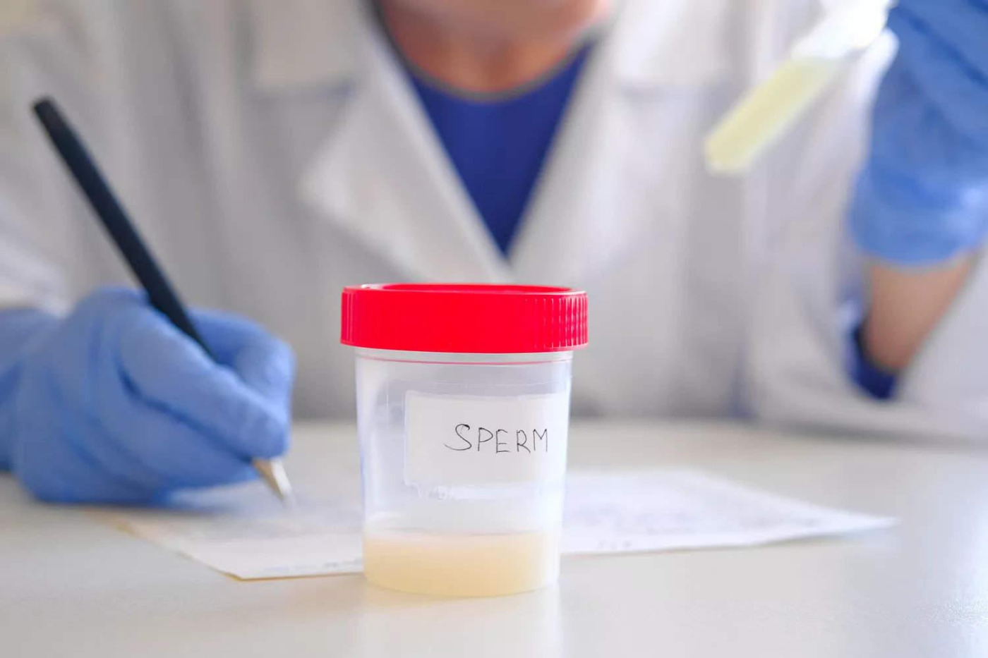 Tinh trùng vón cục màu vàng là bệnh gì và có sao không?