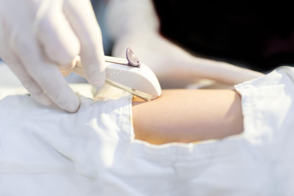 Giải đáp thắc mắc: Cấy que tránh thai có đau không?