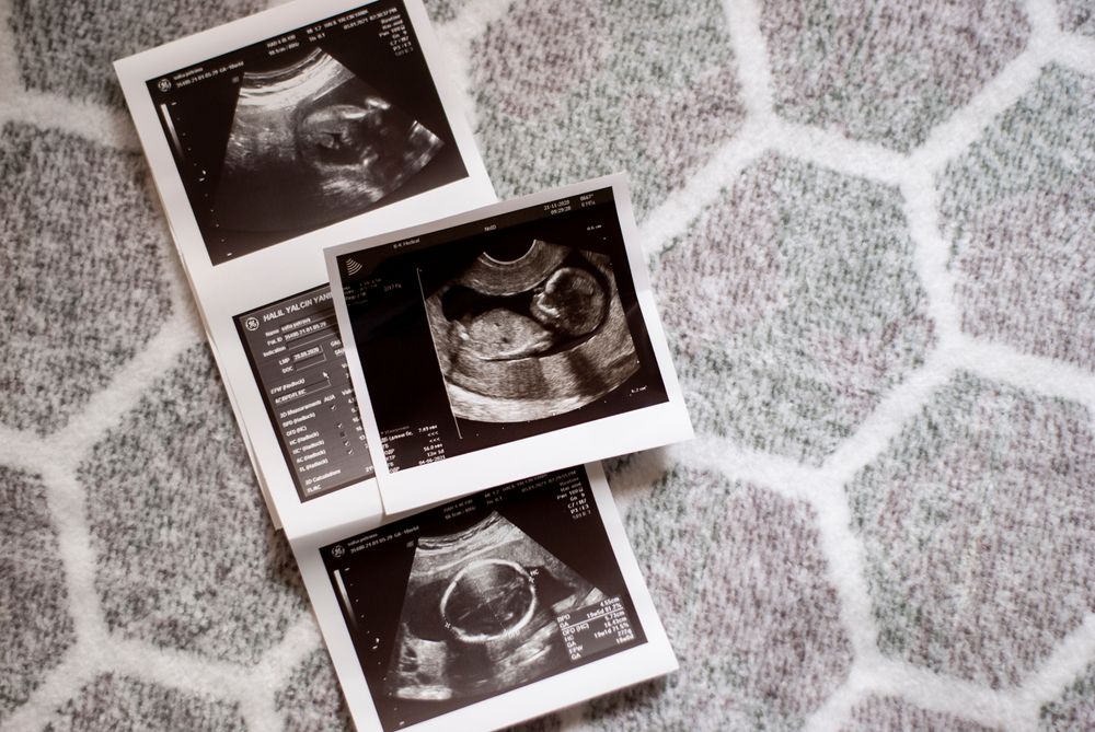 Chỉ số thai nhi theo tuần: Thông tin nào các mẹ bầu cần nắm?