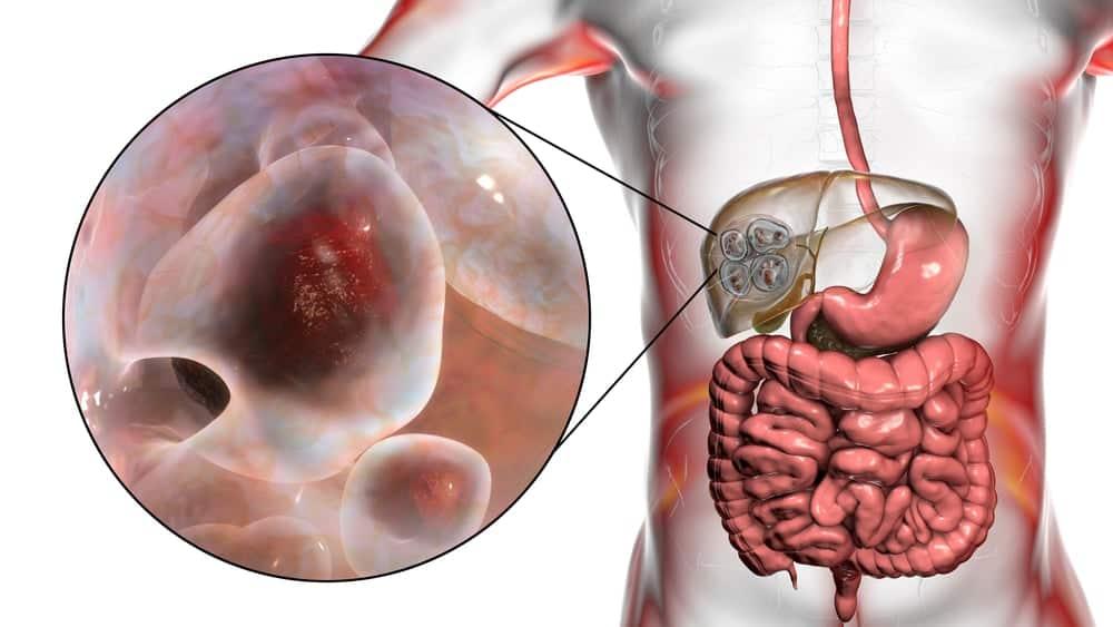 Bệnh sán dải chó