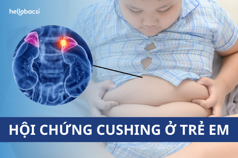 Trẻ thừa cân, béo phì hay đang mắc hội chứng Cushing ở trẻ em?